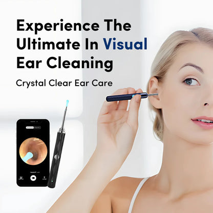 Aura®- Ear Wax Remover