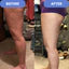 Anti-cellulite 2.0 By Auraa